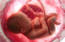 cordon umbilical