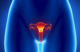 cervical cancer