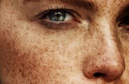 beauty marks